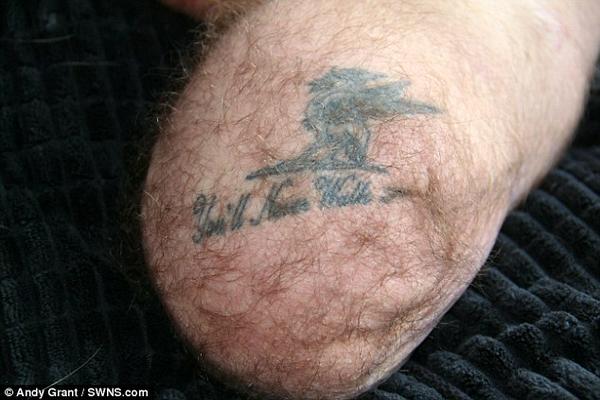 Wicky Surgeons Amputate Royal Marine S Leg His Liverpool Tattoo You Ll Never Walk Alone Now Reads You Ll Never Walk Http T Co Umkgqbyxe8 Twitter