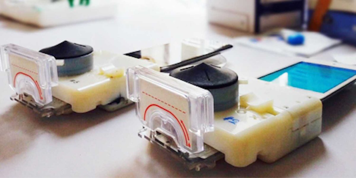 BusinessInsider's tweet image. This $34 smartphone device can diagnose HIV in 15 minutes read.bi/1DCx2YO