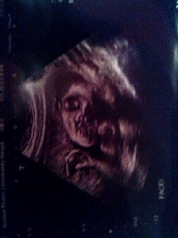 LOOK GUYS! ITS A PICTURE OF ME IN THE WOMB!!!