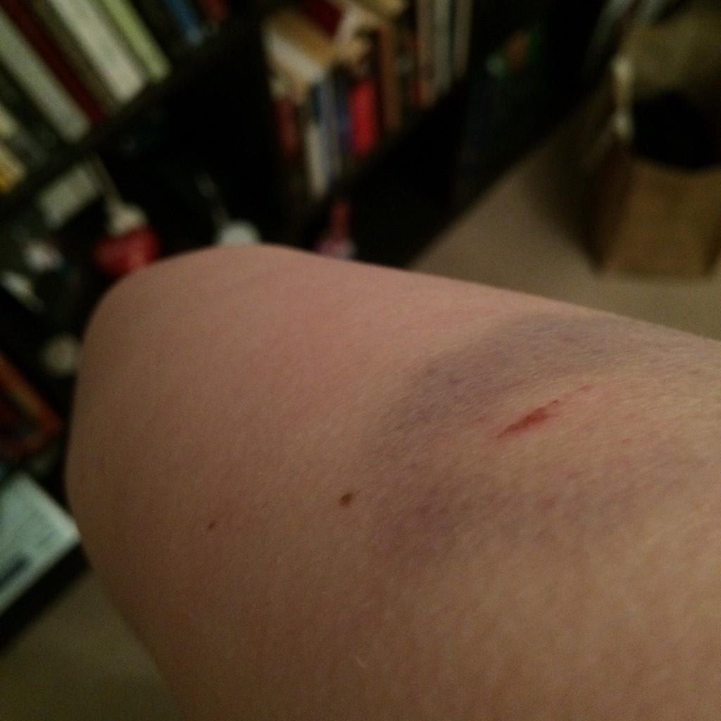 Embedded image permalink