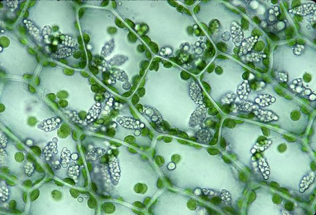 Хлоропласты в клетках листьев крупные. Хлоропласт микрофотография. Клетка элодеи. Клетка растения Элодея. Хлоропласт под микроскопом.