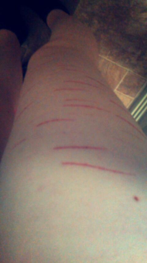 WithinSadness's tweet image. Forever trying to just feel something