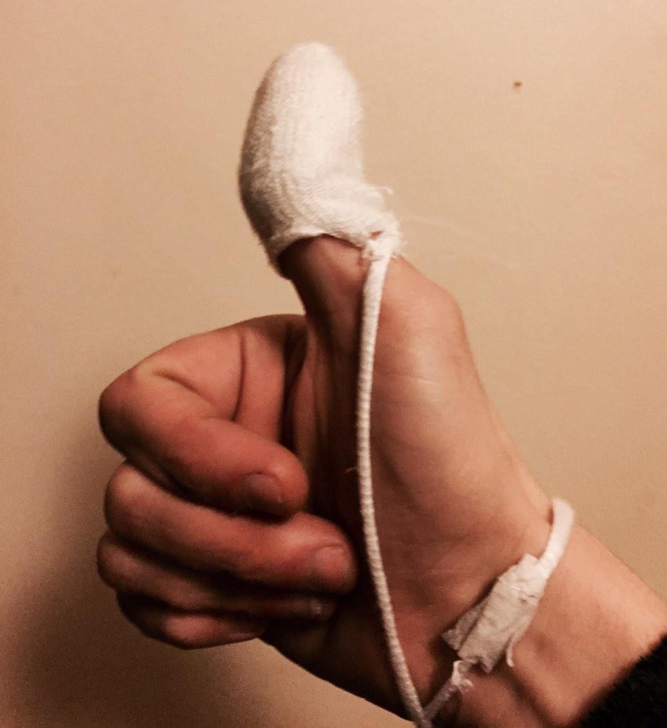 kevachoos's tweet photo. Thanks western general for patching me up.👍 http://t.co/2gFSd2JoYV