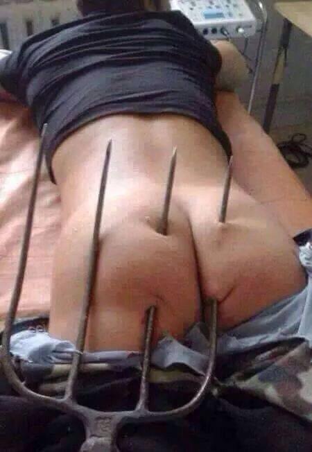 So u want u want to date a farmers daughter??
FYI Forks come in all different shapes and sizes
Pictured is a little 1