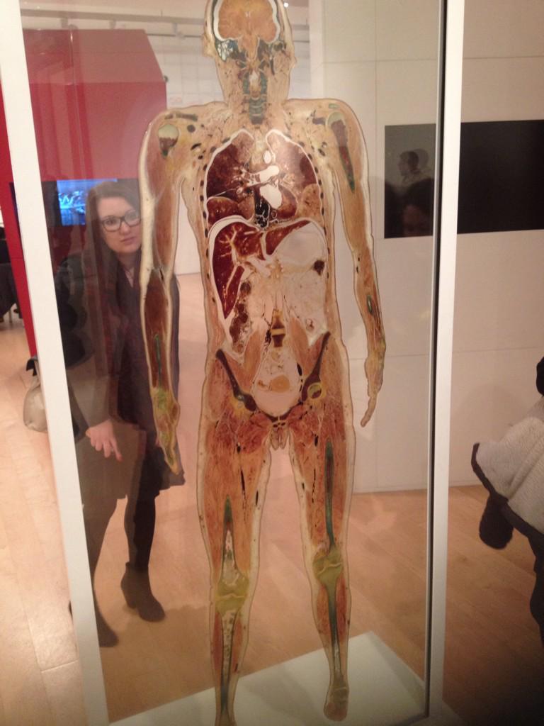 Sam_Cranny's tweet image. A cross section of a human body! Always wanted to see one of these! Amazing! #theWelcomeProject