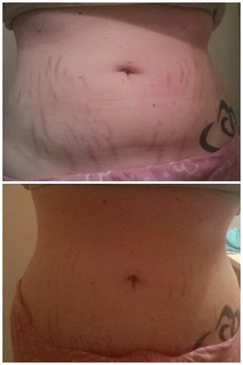 CCoryell7's tweet photo. Before and after 1 wrap. Left on for 1 hour. My results! It works these crazy wraps. :) http://t.co/YyGfMW6dIs