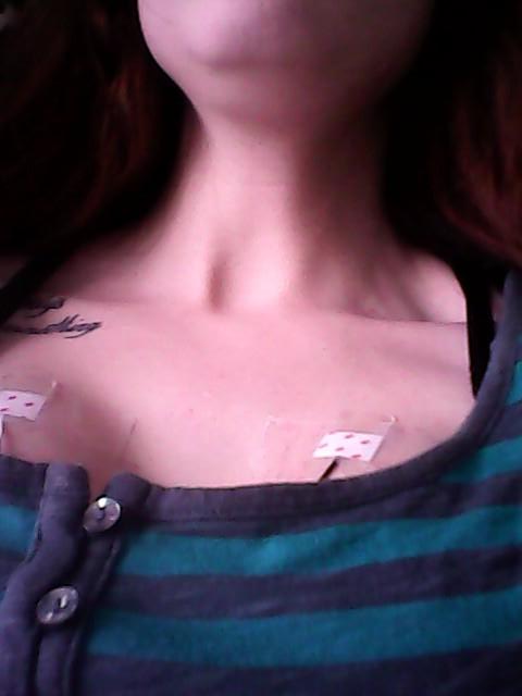depressedstonaa's tweet photo. Admitted >.< gained soooo much. Heart monitor is annoying http://t.co/uVuxSRFMc4