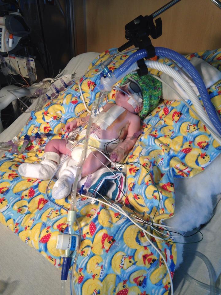 Pray4Jacoby's tweet photo. @Pray4Jacoby: More photos of our sweet lil boy #JacobyStrong #GodIsGood #WHS #WolfHirschhornSyndrome http://t.co/5rpgwzkSTd