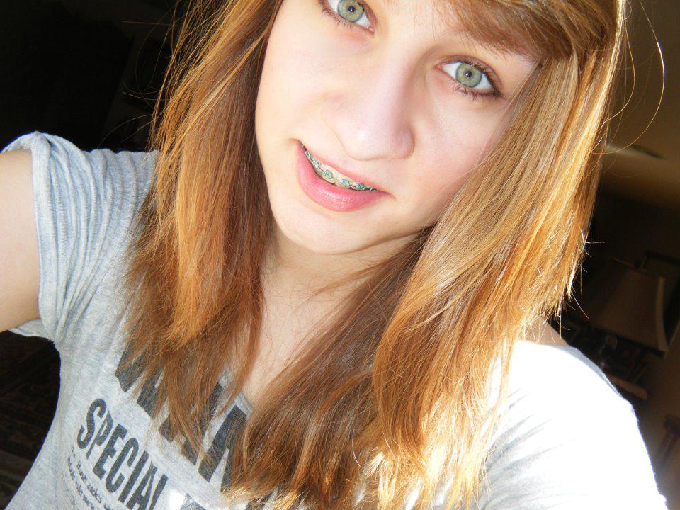 Girls With Braces on Twitter "Cool Braces Colors braces http//t.co