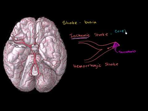 EMA2TRADE2's tweet image. Strokes vid.staged.com/hgyn #staged