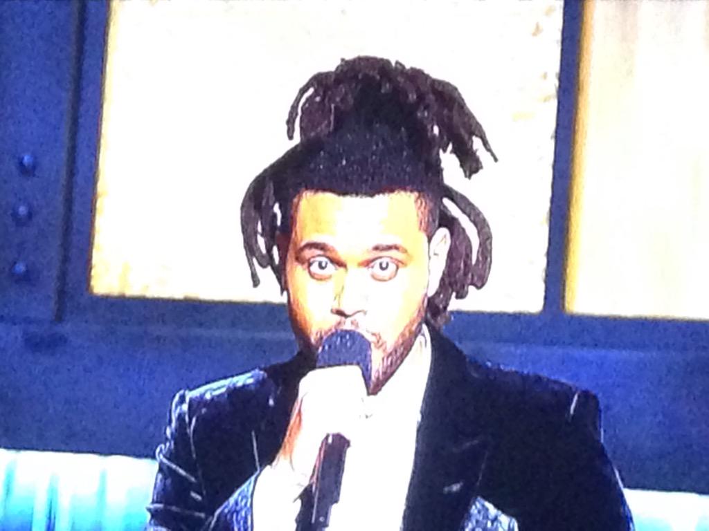 richrice79's tweet photo. What the hell is that thing on his head??? It looks like one of those things from the alien movie :o  #Grammys2015 http://t.co/DhbAHnMjdC