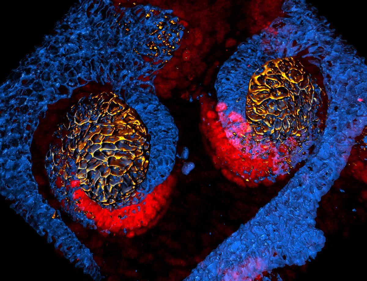 The most beautiful kidney nephrons you'll see all day ow.ly/3x36kR  #video