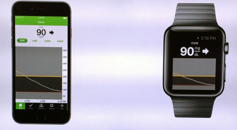 MacRumors's tweet photo. Apple Watch Set to Include Third-Party Glucose Tracking App at Launch http://t.co/CBPYixoXrW by @earthTOmitchel http://t.co/tf7gVhJ5pY