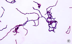 sherlockbones9's tweet photo. Gram positive because of its purple color. It is Cocci because of its round shape. (Streptococcus) #rhsbms #pltw http://t.co/eykVGgUu5d