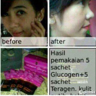 delimaberas's tweet photo. Wajah cling bebas jerawat dan bebas cream.
Yuk pakai GLUCOGEN . Invite 524AC561 @TerusPromo @Ads_IKLAN @iklanin http://t.co/D7ZWoVEgRY