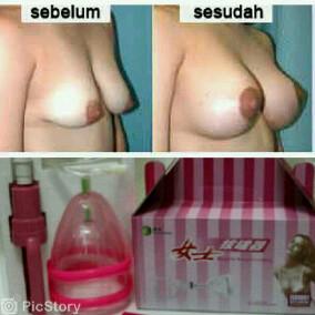 ayuansalma's tweet photo. @juliaperrez saya punya solusi untuk.  Merubah bEntuk Pydr biar montok. Info pin bb 28d8450e http://t.co/cMsF5ytJrg