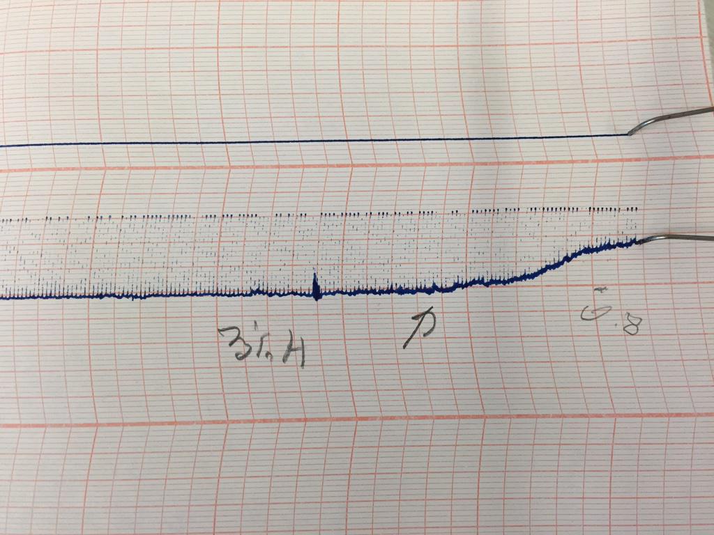 canibagthat's tweet image. Anesthesia quiz: what is being shown here? #gasclass