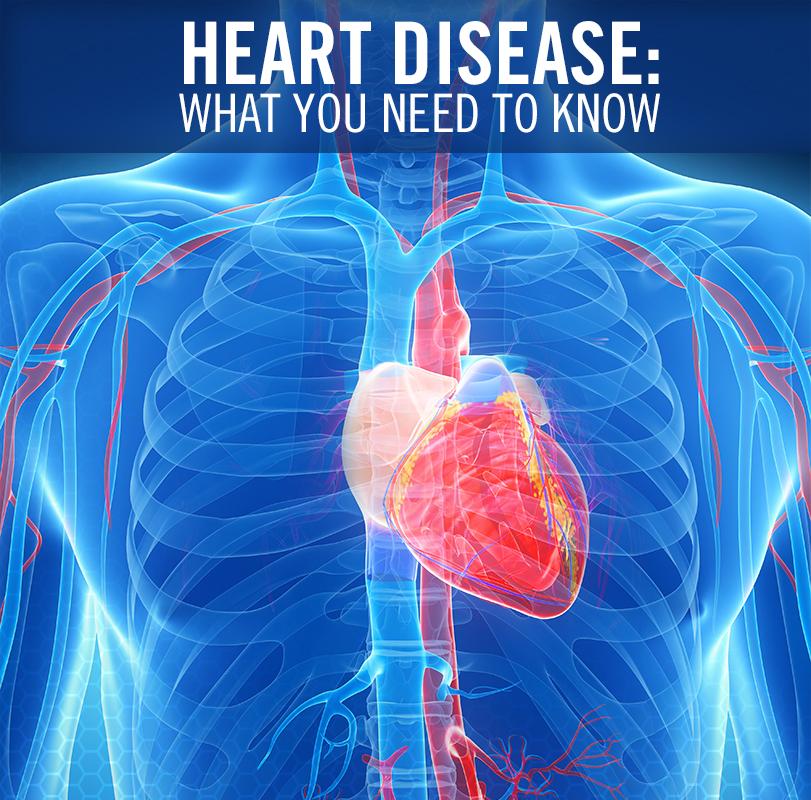 acefitness's tweet image. Heart Disease: What You Need to Know: bit.ly/16QfP3K @LfstylMgmt