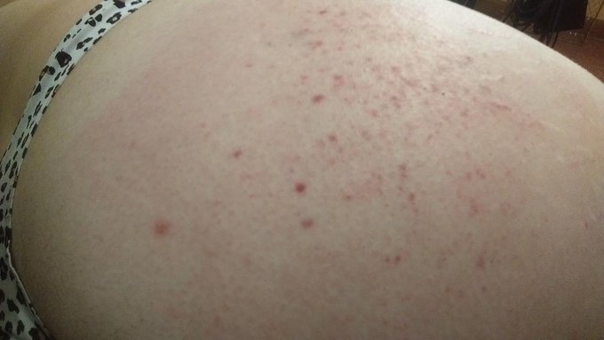 Had a great play session, shout out to my perverts (; @KinkLive Spanked myself so hard I've got blood<a href="/tag/kinky"class="tags"><span>#kinky</span></a>