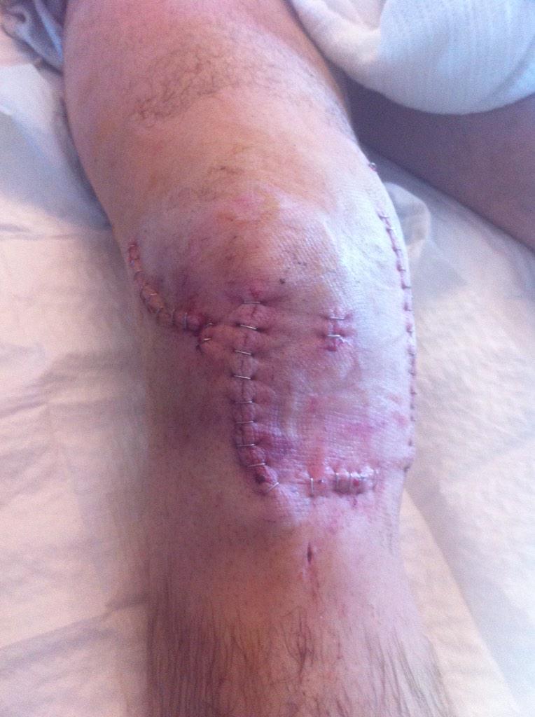 From this - to this.