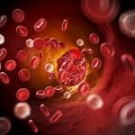 advocatehealth's tweet photo. Could your #arteries be hardening? http://t.co/HTHtVE9y5g http://t.co/xXq0b9wCWx