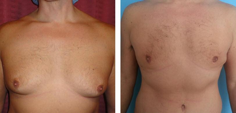 Men can get their fix too! #MyLook #DrTaneja #PlasticSurgery #Improve