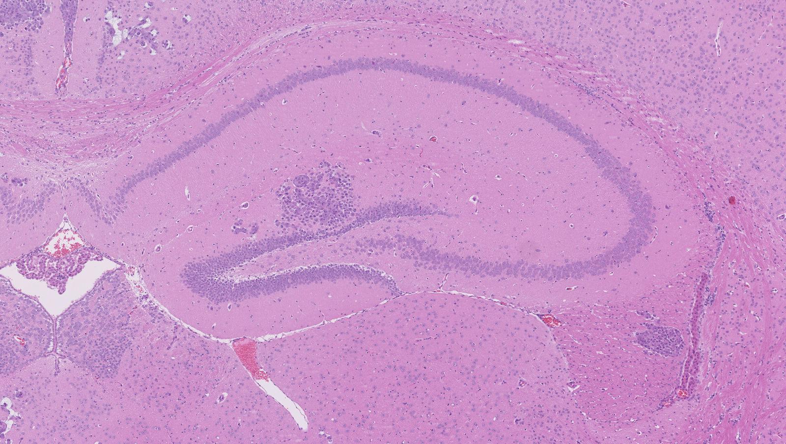 Hippocampus Histology