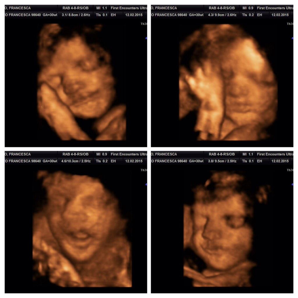 Francesca91x's tweet photo. #babygirl #30weeks #10weekstogo 💖 http://t.co/hXEK799DUm