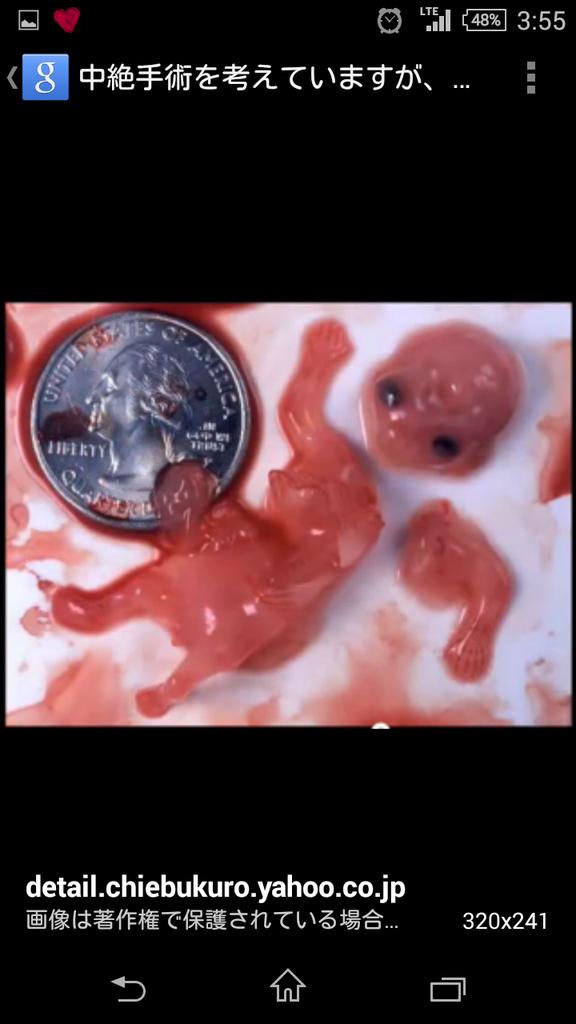 コレクション 中絶赤ちゃん写真 164812