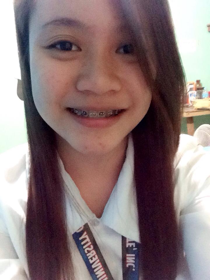 abibermosa_'s tweet image. Wanna connect the dots? 😂🙈 #PimpleProblems