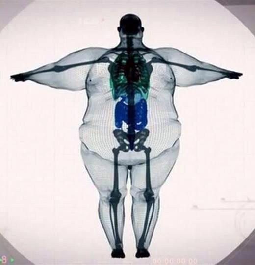 What? Im just big boned!!! #weightlossmyths