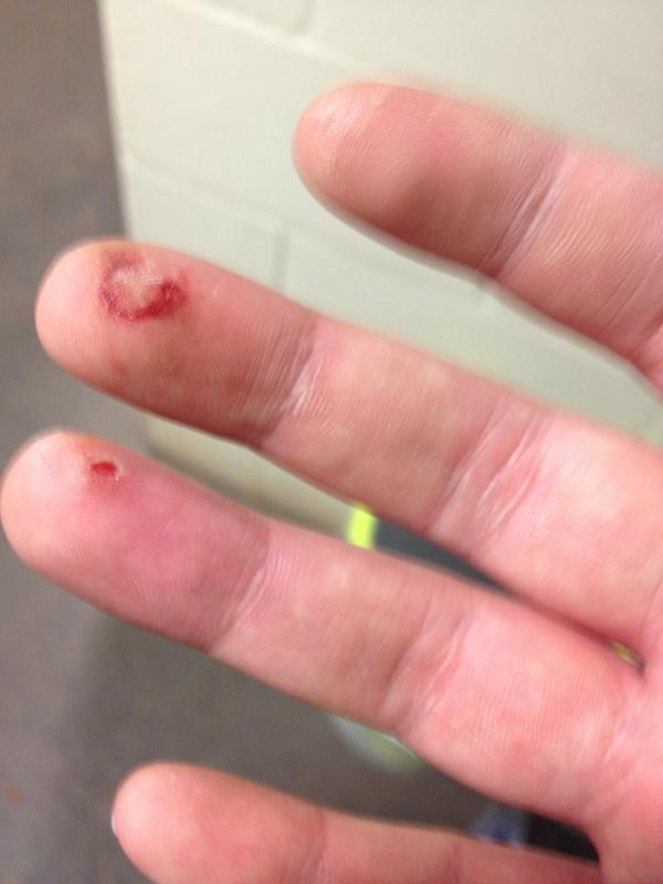 Jackieeeeeee_22's tweet image. #PitcherProblems