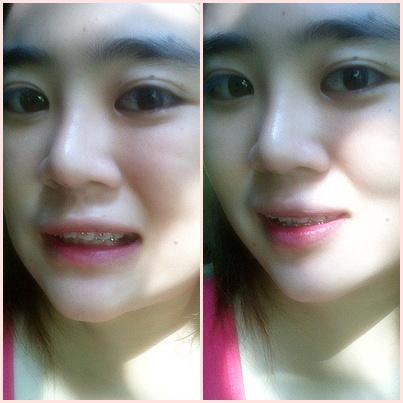 AOMKaA's tweet photo. หน้าเป็นสิว สิวทิ้งรอยดำ หน้าไม่เนียนใส สอบถามดั้ยจ้า http://t.co/EmFsh8Wz