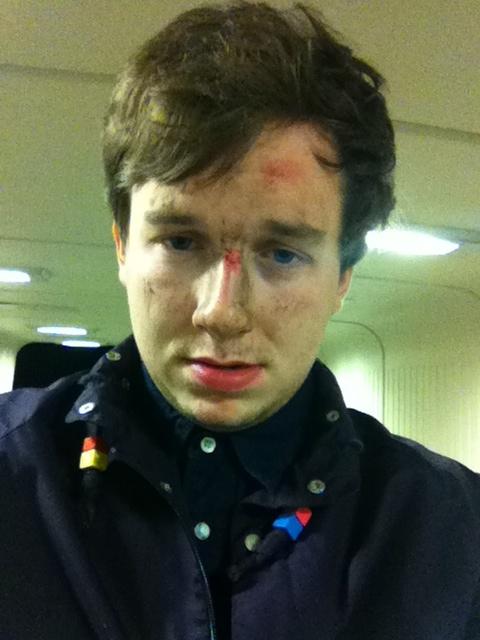 NoCarsScott's tweet photo. "...... OOW! I AM, BADLY HURT!" hashtag ouch http://t.co/jJhKv9fx