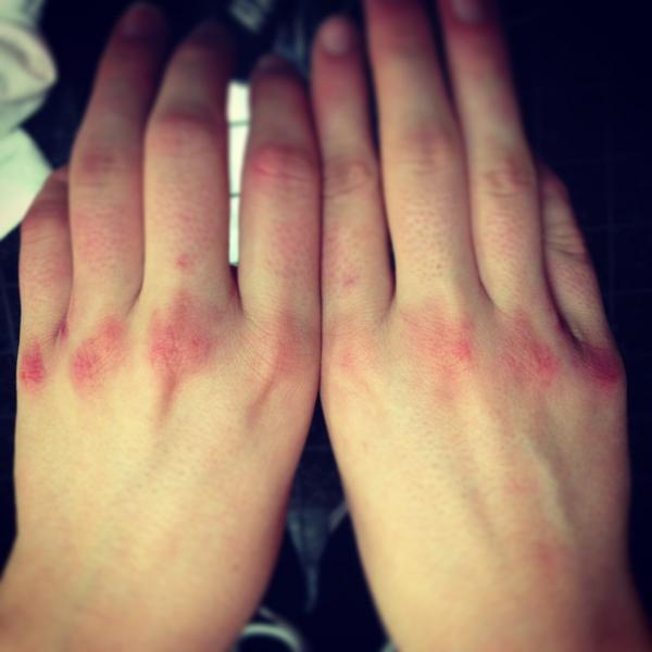 Get at me bro 👊 #MMAconditioning #bloodyknuckles #fightme #crazymofo