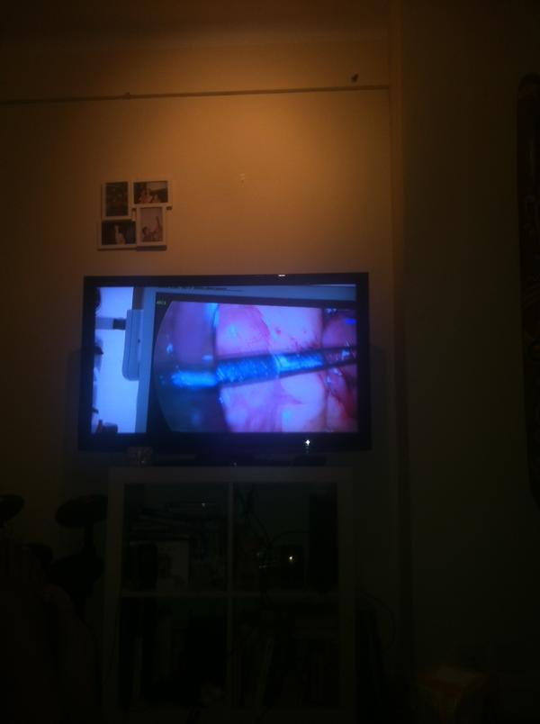 KBocram's tweet photo. Surgery on fat people when I’m eating! Thx @CarlyBrooks http://t.co/2RQYyfOZ