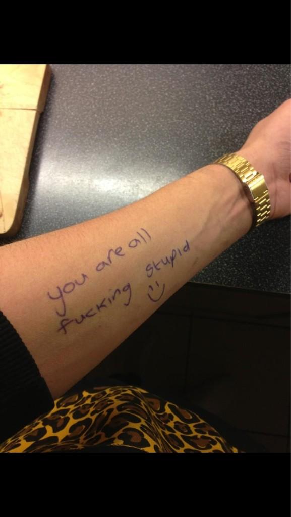 CutForBieber_'s tweet photo. Poor guy carved this in his arm! #cut4beiber #cutforbieber #cuttingforbieber #bieberblaze #weedforbiebs #bieberarmy http://t.co/vXiMN9U1