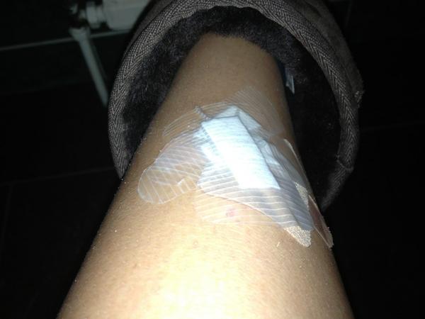 sophrowen's tweet image. Well and truly in the wars this week #NotMyWeek