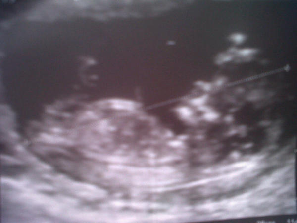 sadierose's tweet photo. One more week and i find out if my babys a boy or a girl so excited http://t.co/pxZDVJrl