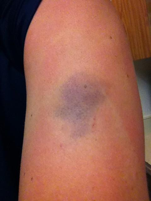 AjtheDickhead's tweet photo. Comes to Florida on vacation and this is what I have to deal with #bully http://t.co/JvMvsLlr