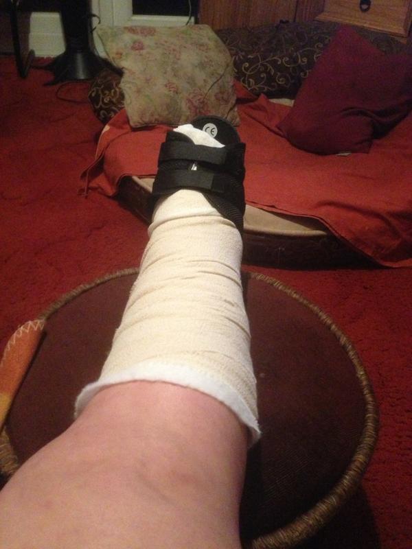 Joanne_Burrell's tweet photo. In so much pain. On mend now I hope http://t.co/8j3uN69P