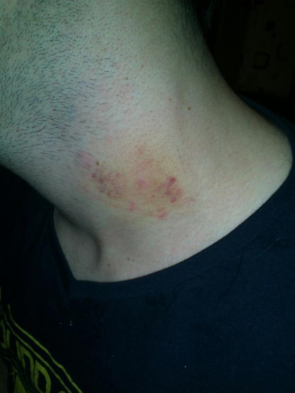 Johnny_easy's tweet photo. Ehm.. okay. Klasse Wochenende, woher kommt das?! http://t.co/7BLI4vWg