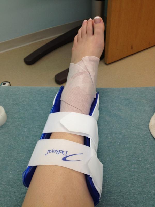 Crutches For Sprained Ankle