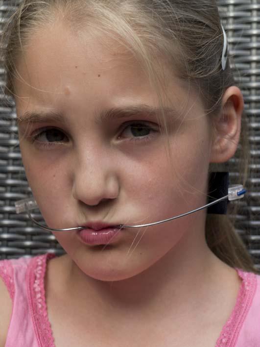 WandaAbbing's tweet photo. @milabente_ Dan ben je hier tenminste van af #beugel http://t.co/CrpYL4hC