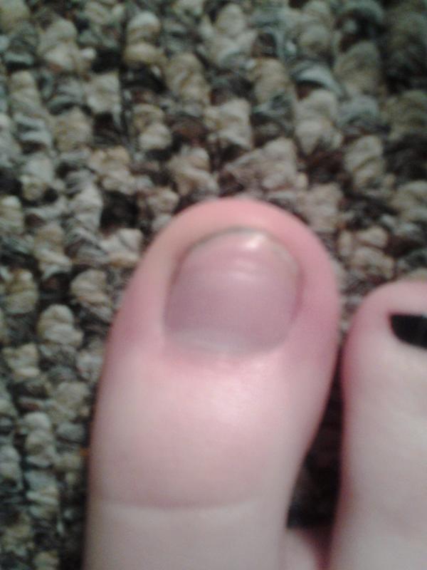 And 6 months, pretty much better! :) #yay #blurry