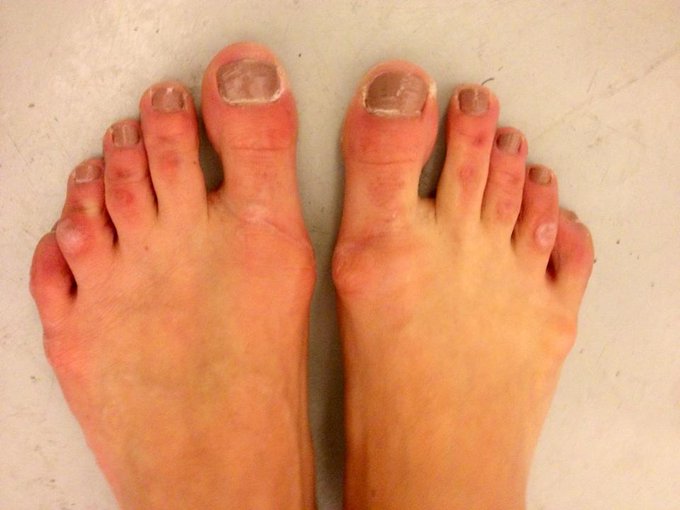 Couldn't look more model #feet http://t.co/DsAjHzaS<a href="/tag/feet"class="tags">#feet</a>
