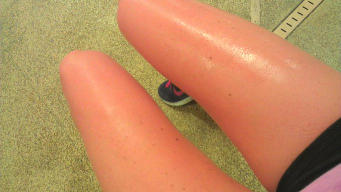Bright red and glistening with sweat.... Damn that was a good workout! http://t.co/C6j6Lkqt<a href="/tag/fuckyeah"class="tags"><span>#fuckyeah</span></a>