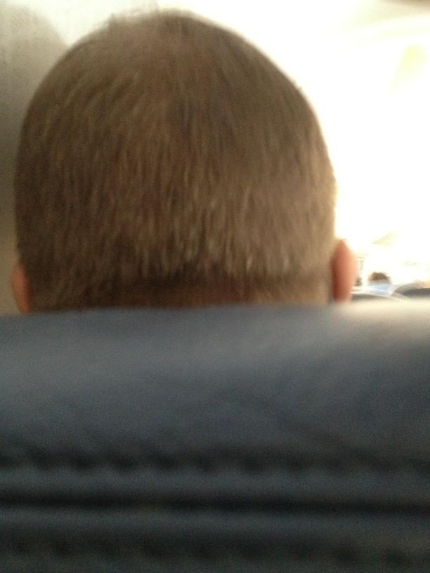 Bob Marley on Twitter "see the big fat head? This is the lump in front