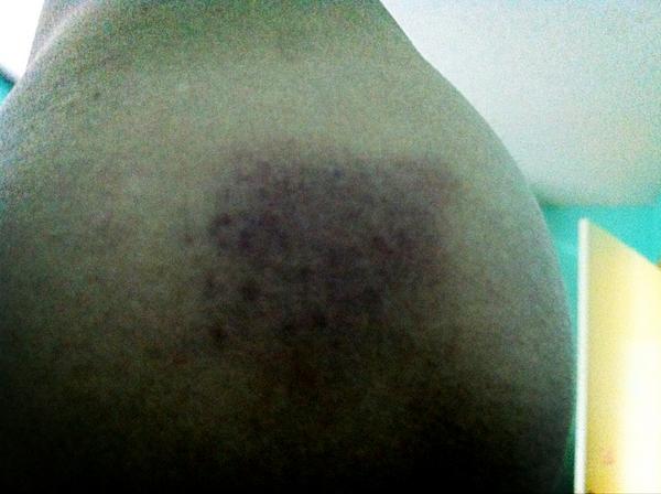 sarah_kuramoto's tweet image. Gee thanks Angelo.. #violentbf #jk #obstaclecoursefun #iwon