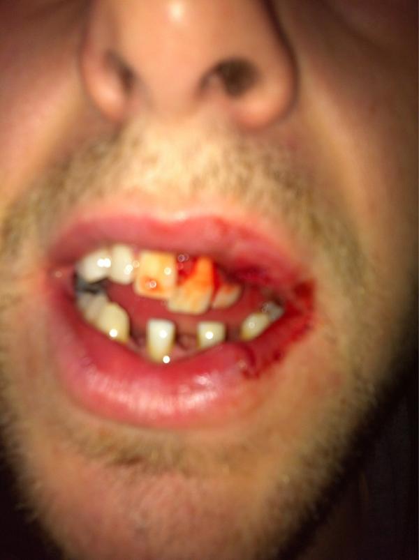 SaskHomes4Sale's tweet image. "@bombsaway4: Just another Saturday night in the FCHL #dashfiveonthecareer http://t.co/2rN2pfnl" #grittyperformance #bigwin